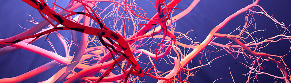 immagine header centro eccellenza malattie vascolari