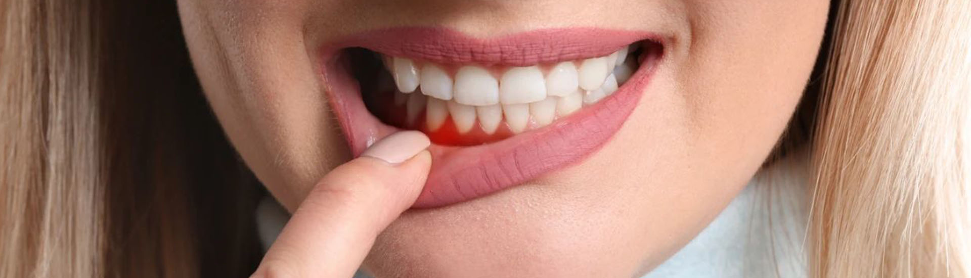 parodontologia s-medical sora