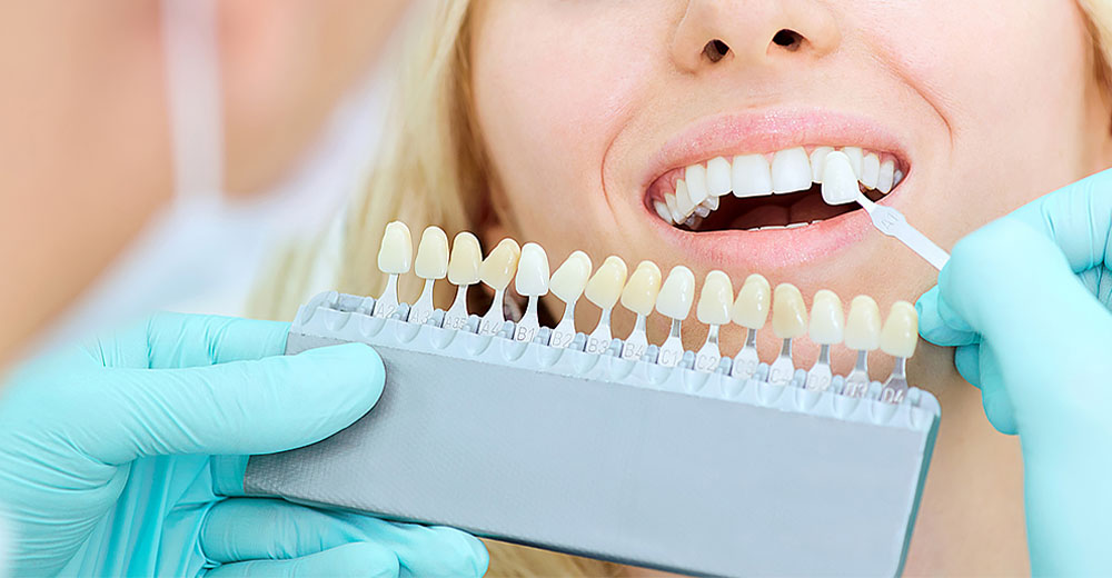 protesi dentale mobile e fissa s-medical sora mobile