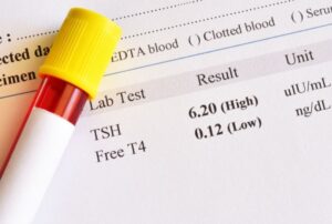 Scopri di più sull'articolo  Analisi della tiroide a Sora | S-Medical