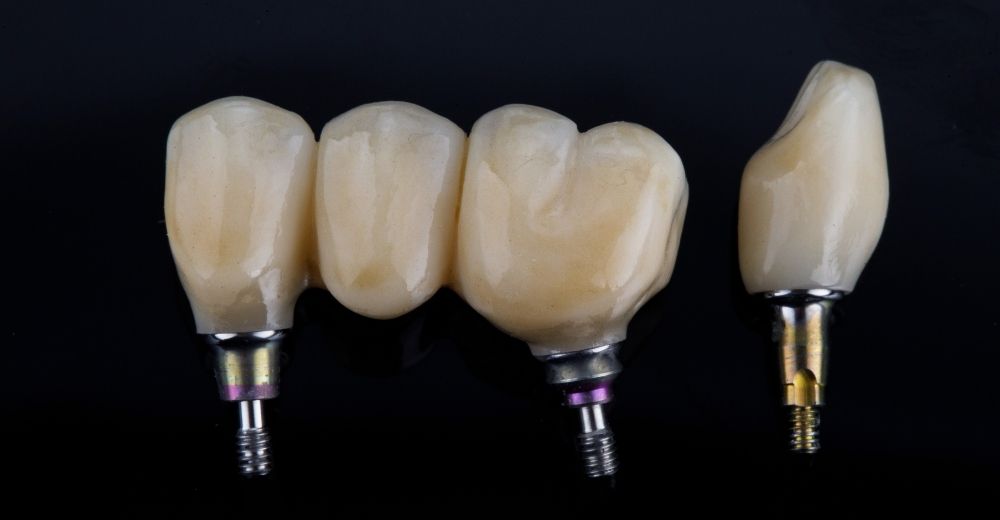 California Bridge - S-Medical Group Sora- Formato Foto Testo