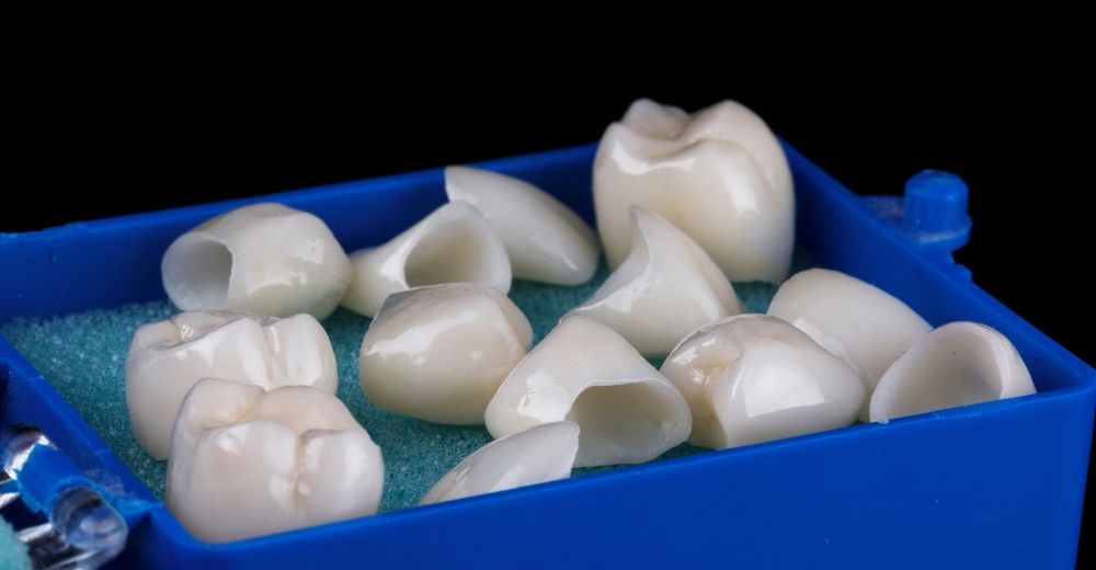 Corona Dentale - S-Medical Group Sora- Formato Foto Testo