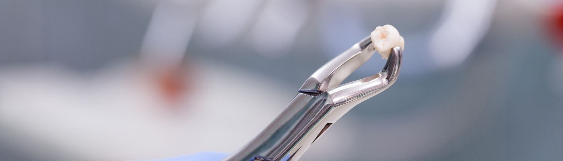 Estrazione dente - S-Medical Group Sora - Formato Desktop