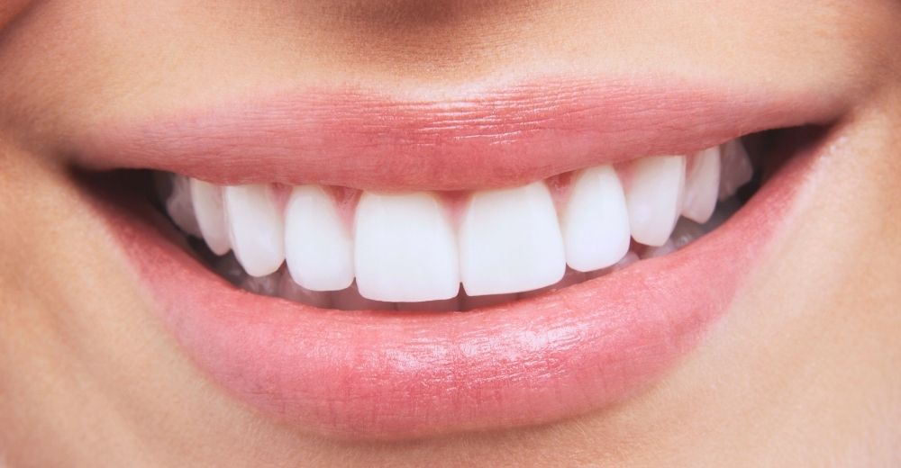 Frenulectomia - S-Medical Group Sora - Formato Foto Testo