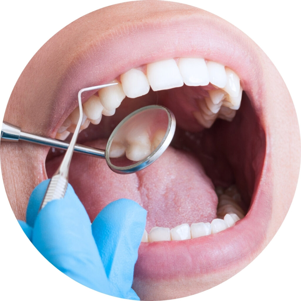 Immagini-Landing-icona-DIAGNOSTICA-DENTALE.jpg
