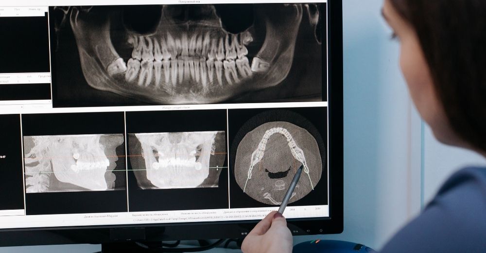 Implantologia computer guidata - S-Medical Group Sora - Formato Foto Testo