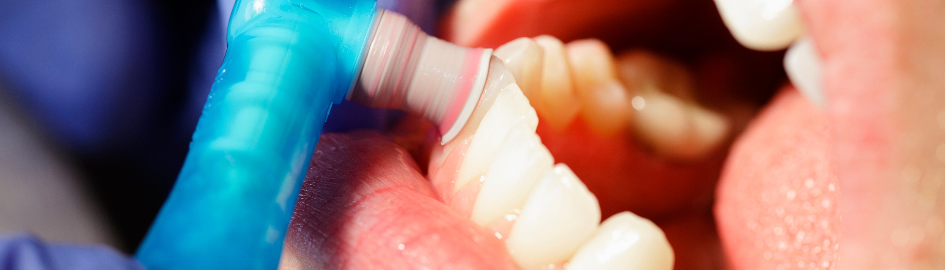 Lucidatura Dentale - S-Medical Group Sora- Formato Desktop