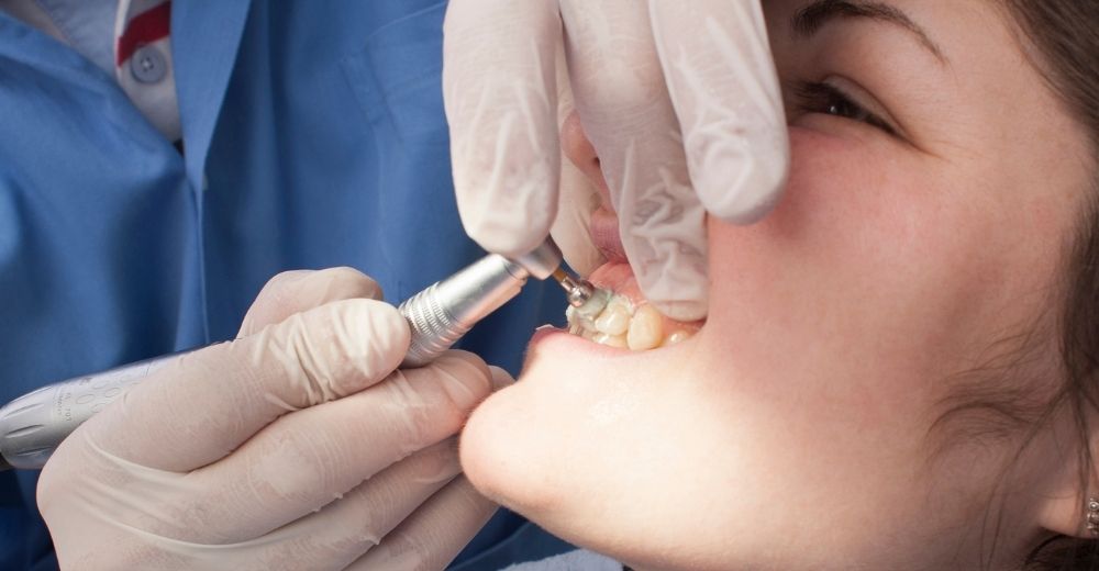 Lucidatura Dentale - S-Medical Group Sora - Formato Foto Testo