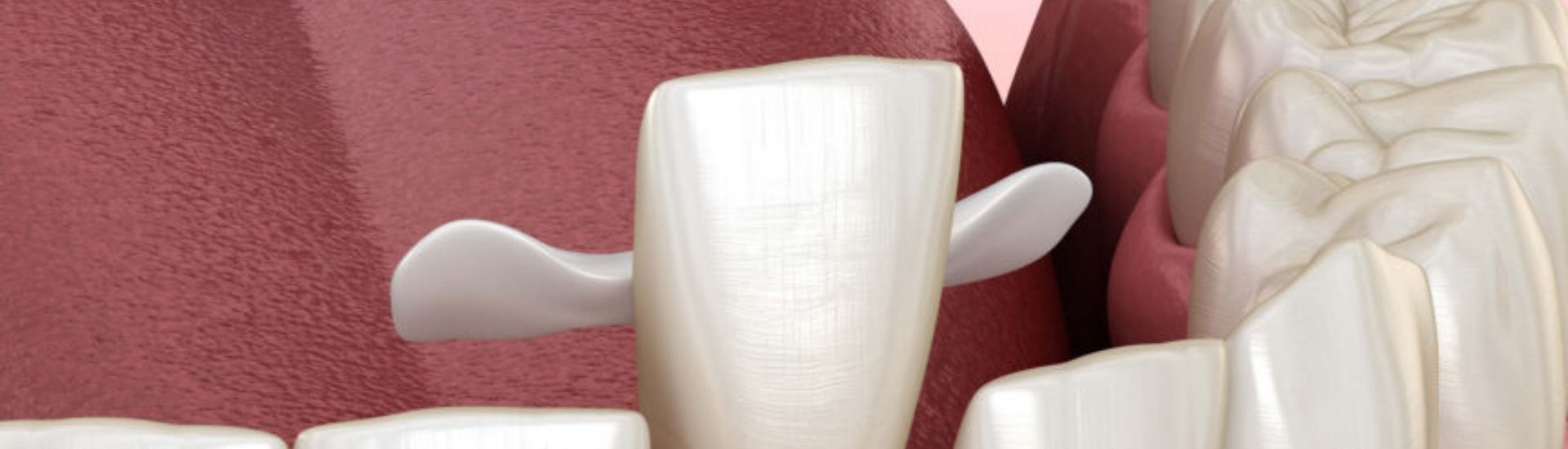 Maryland Bridge - S-Medical Group Sora- Formato Desktop