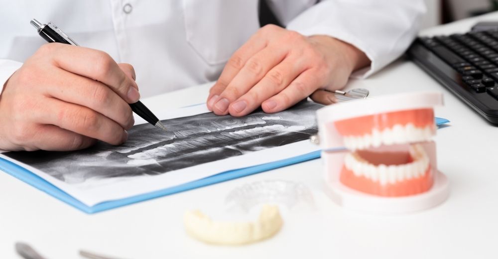 Rialzo del seno mascellare - S-Medical Group Sora - Formato Foto Testo