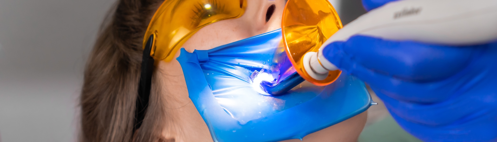 Sigillatura Dentale - S-Medical Group Sora- Formato Desktop