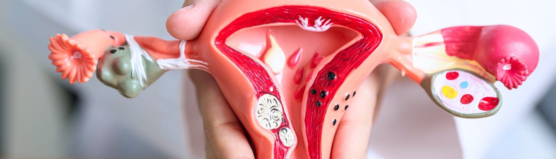 Trattamento dei fibromi - S-Medical Group Sora - Formato Desktop