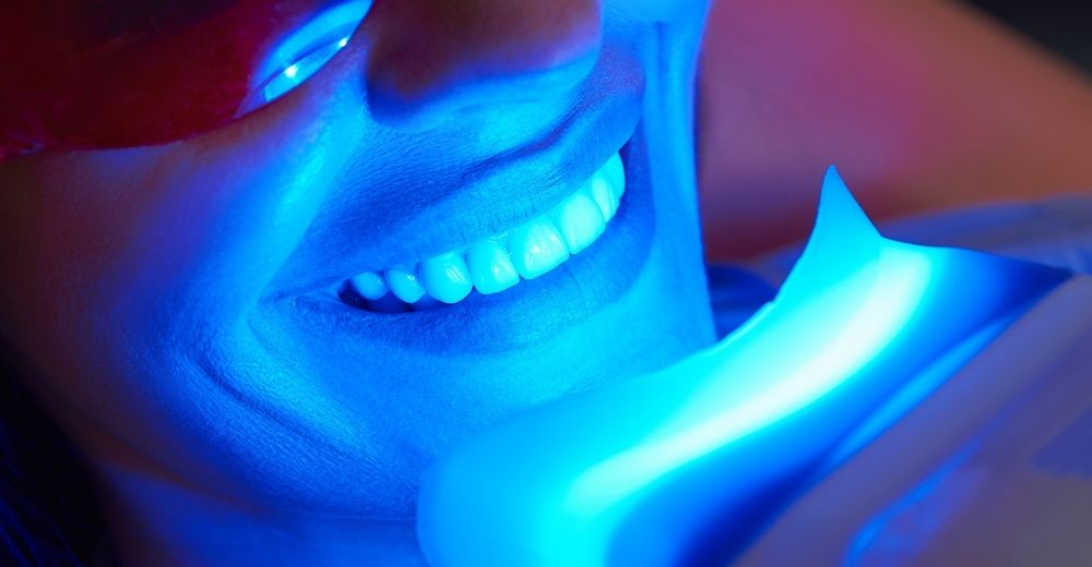 Trattamento delle macchie bianche dello smalto - S-Medical Group Sora- Formato Foto Testo