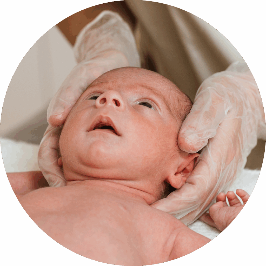 Plagiocefalia posizionale del neonato