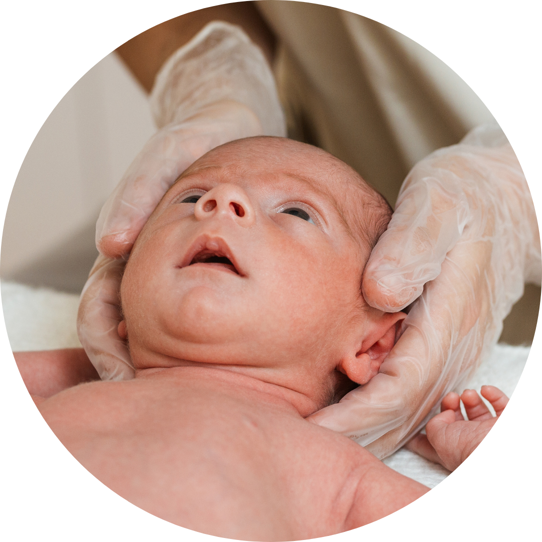 Plagiocefalia posizionale del neonato