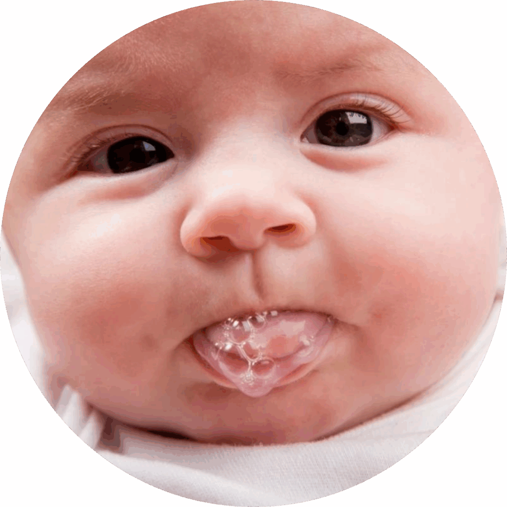 Reflusso gastroesofageo