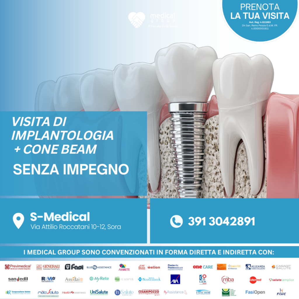 Tariffe del Mese Poliambulatorio S-Medical Sora VISITA DI IMPLANTOLOGIA + CONE BEAM