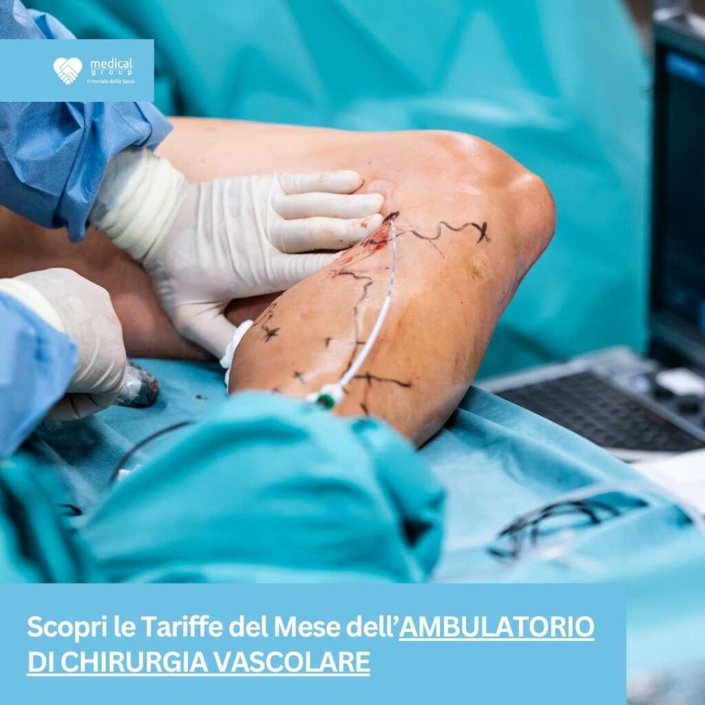 Tariffe del Mese Ambulatorio Chirurgia Vascolare S-Medical Group Sora