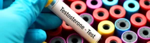 analisi testosterone - medical group italia